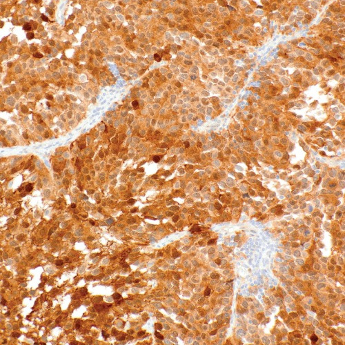 CDK4 Rabbit Monoclonal Antibody(ARM609)