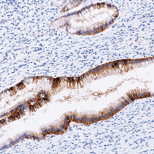Claudin 18.2 Rabbit Monoclonal Antibody(ARM611)