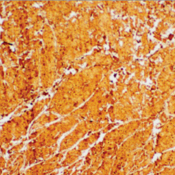 cTnI Mouse Monoclonal Antibody(ARM612)