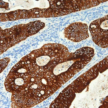 Cytokeratin CAM5.2 Mouse Monoclonal Antibody(ARM613)