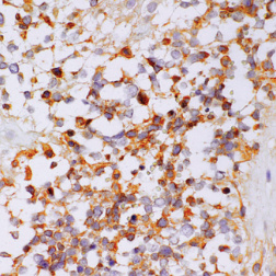 D-Dimer Mouse Monoclonal Antibody(ARM614)