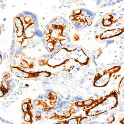 Flt-1/VEGFR1 Rabbit Monoclonal Antibody(ARM618)
