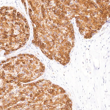 Glutamine Synthetase Mouse Monoclonal Antibody(ARM619)