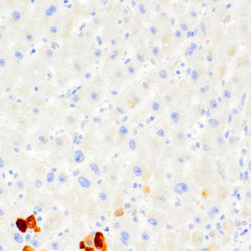 HBcAg Mouse Monoclonal Antibody(ARM620)