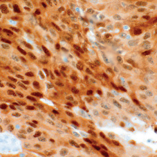 Heat Shock Protein 70 Mouse Monoclonal Antibody(ARM621)