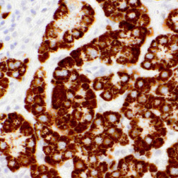 Hepatocyte Specific Antigen Mouse Monoclonal Antibody(ARM622)