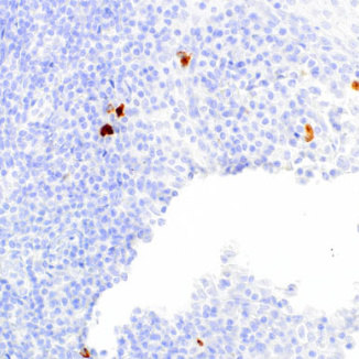 IgG4 Mouse Monoclonal Antibody(ARM626)