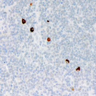 IgM Mouse Monoclonal Antibody(ARM627)