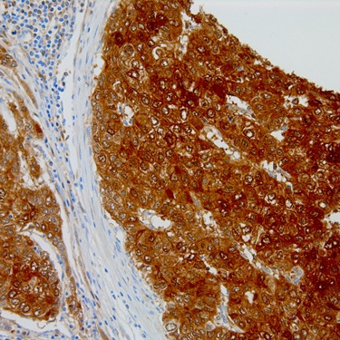 LFABP Mouse Monoclonal Antibody(ARM629)