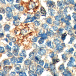 Lp-PLA2 Mouse Monoclonal Antibody(ARM630)