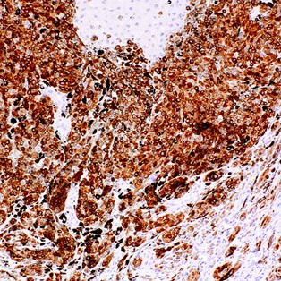 MART-1 (Melan A) Mouse Monoclonal Antibody(ARM631)