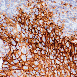 MCT4 Mouse Monoclonal Antibody(ARM632)