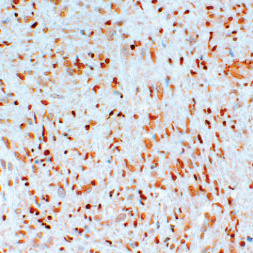 MGMT Mouse Monoclonal Antibody(ARM633)