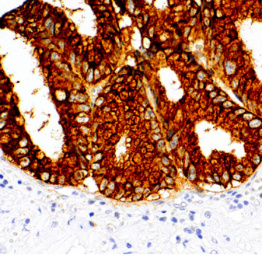 MUC2 Mouse Monoclonal Antibody(ARM634)