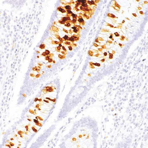 MUC6 Mouse Monoclonal Antibody(ARM635)