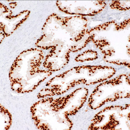 NKX3.1 Rabbit Monoclonal Antibody(ARM637)
