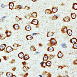 NRP1 Rabbit Monoclonal Antibody(ARM638)