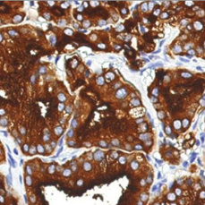 Prostate Specific Membrane Antigen Rabbit Monoclonal Antibody(ARM640)