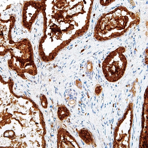 Prostatic Acid Phosphatase Mouse Monoclonal Antibody(ARM641)