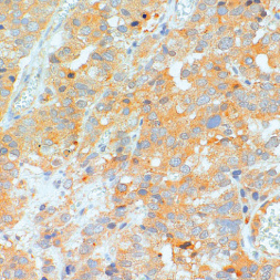 Siglec-15 Mouse Monoclonal Antibody(ARM644)