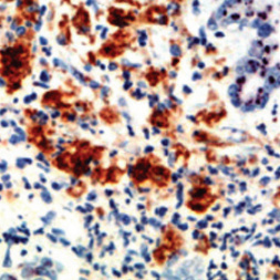 Sonic Hedgehog Rabbit Monoclonal Antibody(ARM645)