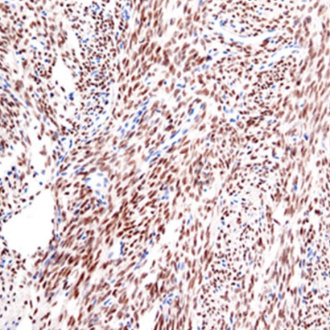 SS18-SSX Rabbit Monoclonal Antibody(ARM647)