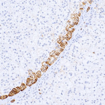 CYP11B2 Mouse Monoclonal Antibody(ARM652)