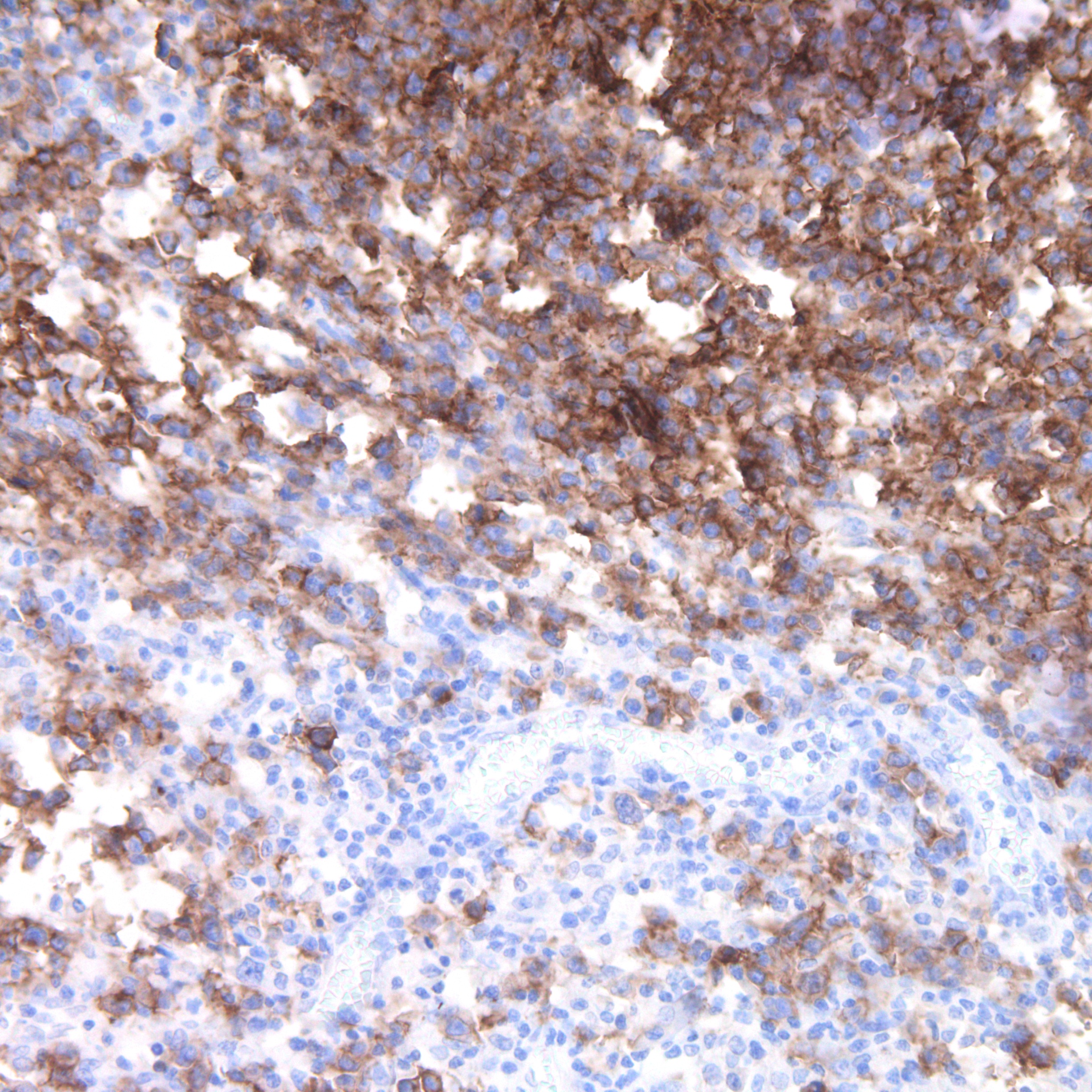FCRL4/IRTA1 Rabbit Monoclonal Antibody(ARM655)